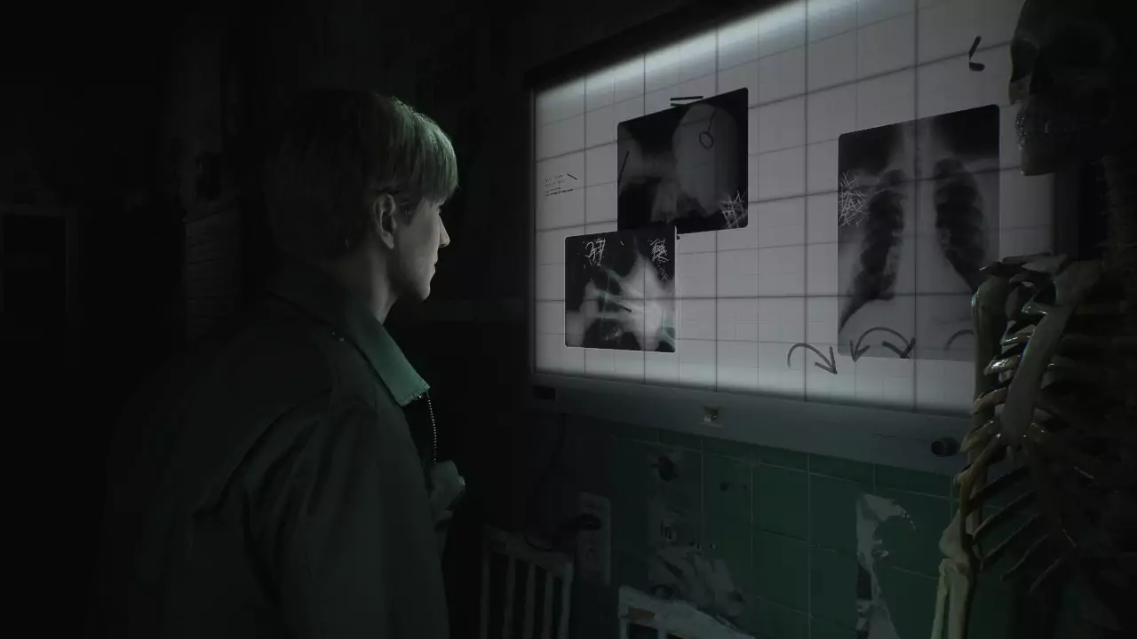 Silent Hill 2: Bloober Team clarifies that if you want more information, ask Konami